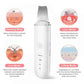 Ultrasonic Skin Spatula Clean Exfoliate Rejuvenate Your Skin