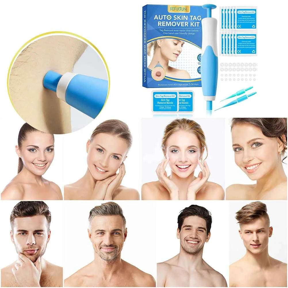 Clear Skin Safely Remove Skin Tags at Home