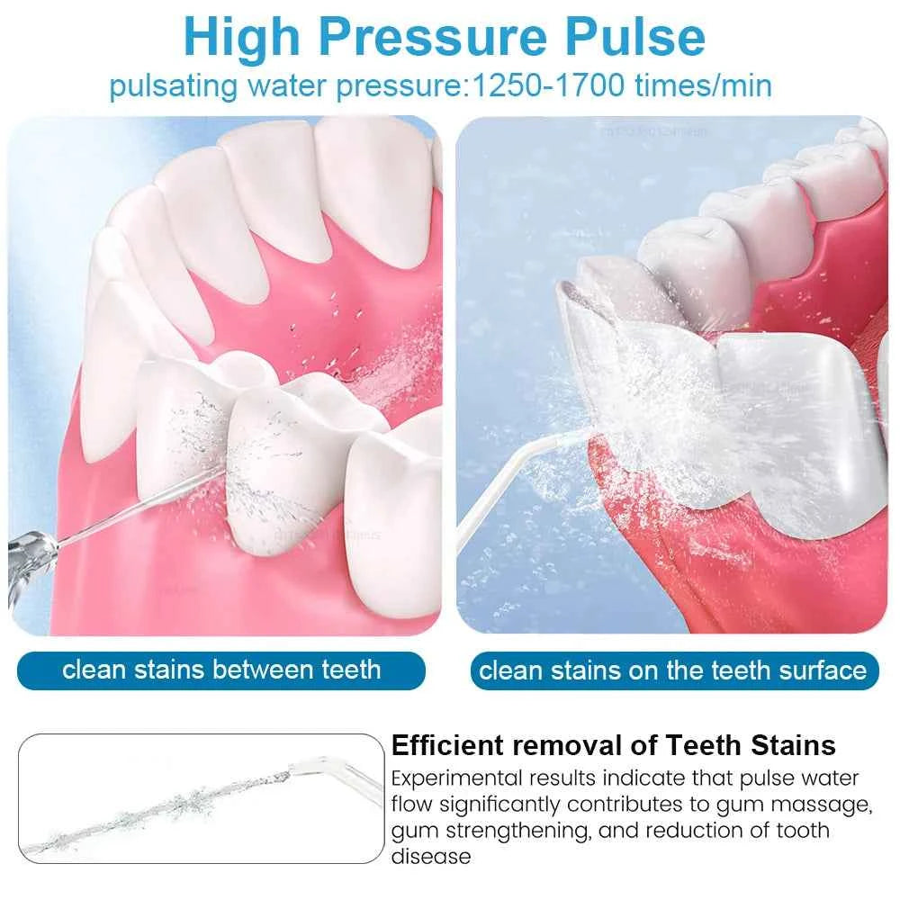 Powerful 800ml Electric Water Flosser for Deep Dental Cleaning