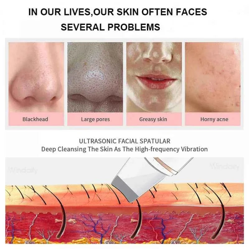 Ultrasonic Skin Spatula Clean Exfoliate Rejuvenate Your Skin