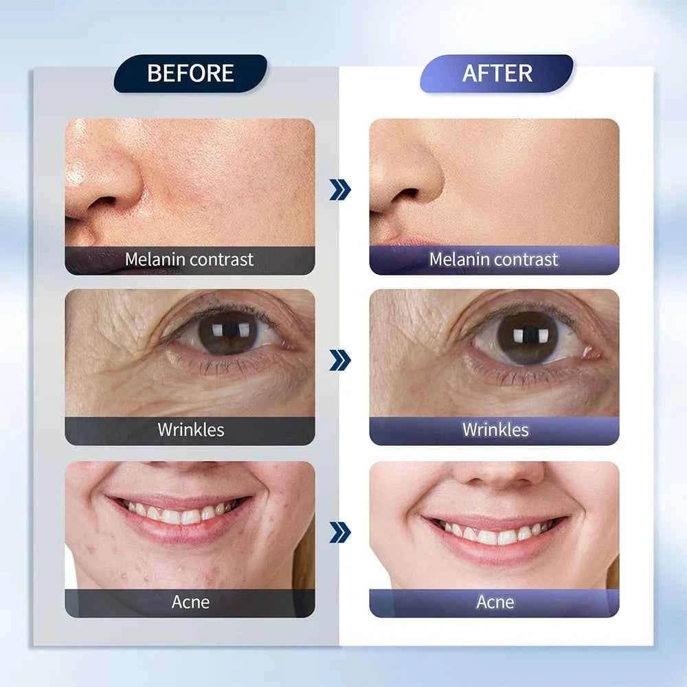 Foreverlily 7Color LED Therapy for Radiant Skin