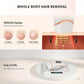 Zimonto - AMOTAOS IPL Hair Removal Versatile Efficient Perfect Gift